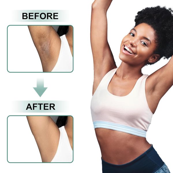 Skin Bleaching Cream Vcetree Body Cream Vitamin E-6