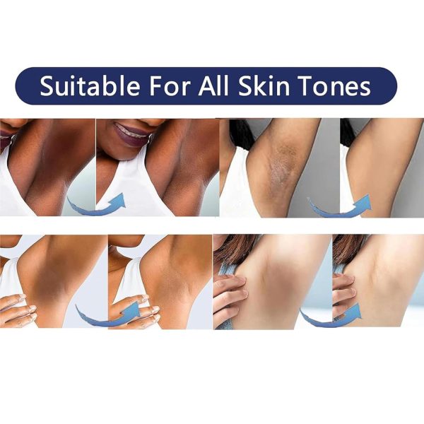 Skin Bleaching Cream Vcetree Body Cream Vitamin E-3